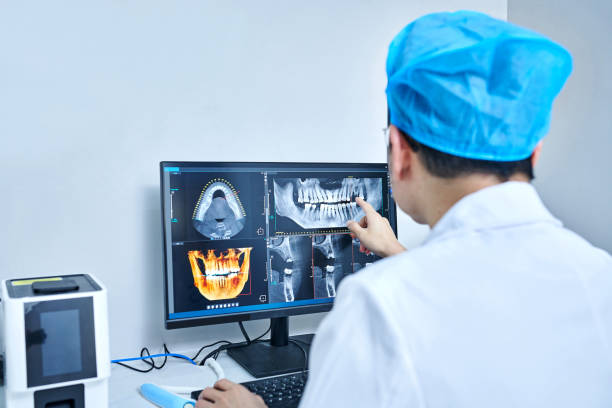 Best Emergency Tooth Extraction in Basile, LA